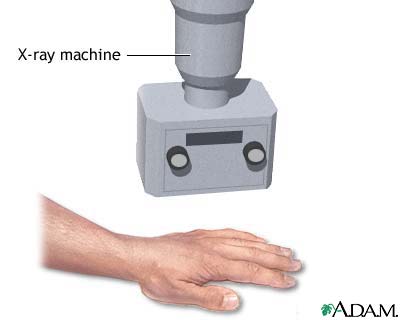 Hand X-ray Hand X-ray