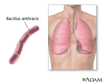 Bacillus anthracis Bacillus anthracis