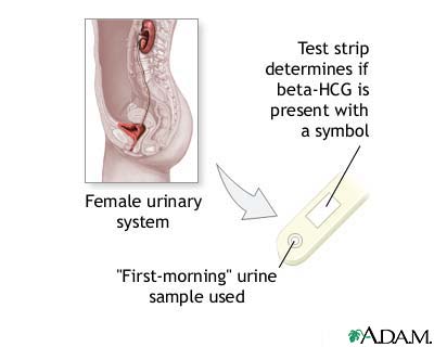 Pregnancy test Pregnancy test