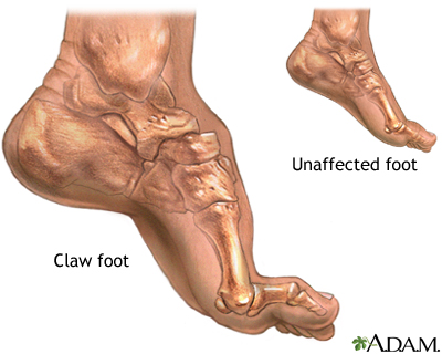 Claw foot Claw foot