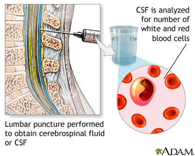 CSF cell count CSF cell count