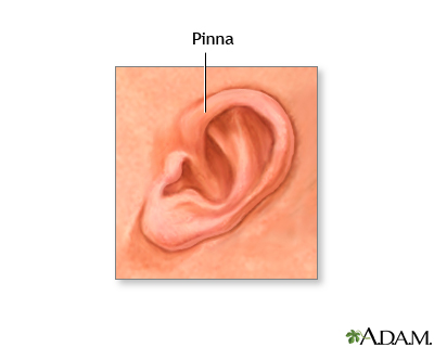 Pinna of the newborn ear Pinna of the newborn ear