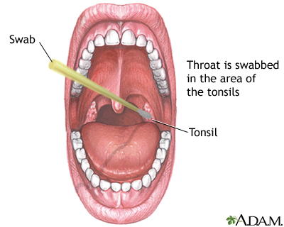 Throat swabs Throat swabs