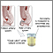 Osmolality test Osmolality test