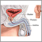 Prostatectomy - series - Normal anatomy Prostatectomy - series - Normal anatomy