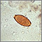 Trichuris trichiura egg Trichuris trichiura egg