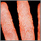 Dermatitis - reaction to tinea