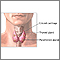 Parathyroidectomy - normal anatomy Parathyroidectomy - normal anatomy