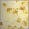 Legionnaire disease - organism legionella Legionnaire disease - organism legionella