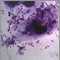 Pneumococci organism Pneumococci organism