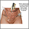 Pelvic laparoscopy Pelvic laparoscopy