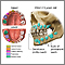 Development of baby teeth Development of baby teeth