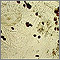 Scabies mite - photomicrograph of the stool Scabies mite - photomicrograph of the stool
