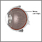 Retinal detachment repair - normal anatomy Retinal detachment repair - normal anatomy