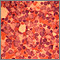 Chronic myelocytic leukemia Chronic myelocytic leukemia