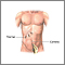 Laparoscopic surgery - series - Incision Laparoscopic surgery - series - Incision