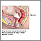 Emergency Childbirth Emergency Childbirth