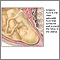 Amniotic fluid Amniotic fluid