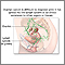 Ovarian cancer dangers Ovarian cancer dangers
