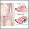 Ovarian growth worries Ovarian growth worries
