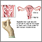The wet mount vaginitis test The wet mount vaginitis test