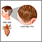 Head lice Head lice