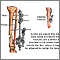 External fixation device External fixation device