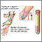 PSA blood test PSA blood test