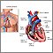 Swan Ganz catheterization Swan Ganz catheterization