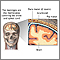 Meninges of the brain Meninges of the brain