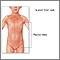 Signs of scarlet fever Signs of scarlet fever