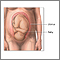 Breech - series Breech - series