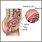 Chorionic villus sampling - normal anatomy Chorionic villus sampling - normal anatomy