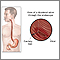 Gastroscopy procedure Gastroscopy procedure