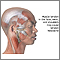 Tension-type headache Tension-type headache