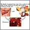 Cholesterol producers Cholesterol producers