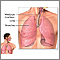 Lower respiratory tract Lower respiratory tract