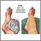 Early treatment of injury Early treatment of injury