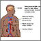 Obesity and health Obesity and health