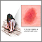 Bruise healing - series Bruise healing - series