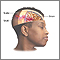 Head injury Head injury