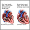 Heart beat Heart beat