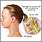 Spinal cord injury Spinal cord injury