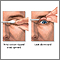 Eyelid eversion Eyelid eversion