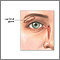 Lacrimal gland Lacrimal gland