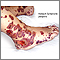 Henoch-Schonlein purpura Henoch-Schonlein purpura