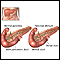 Pancreas divisum Pancreas divisum