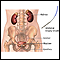 Ureteral biopsy Ureteral biopsy