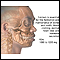 Calcium benefit Calcium benefit