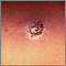 Leishmania panamensis - close-up Leishmania panamensis - close-up
